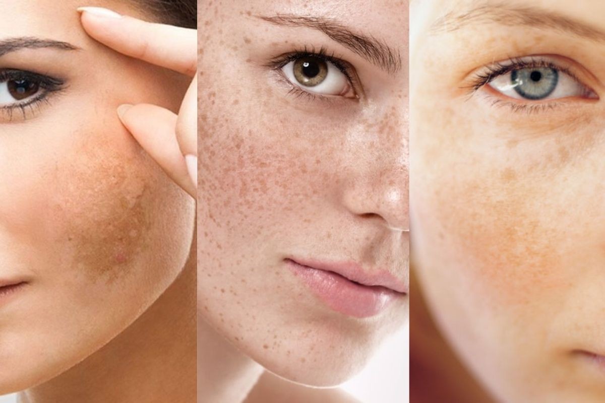 X2 Tác dụng với collagen với 5 lưu ý đơn giản